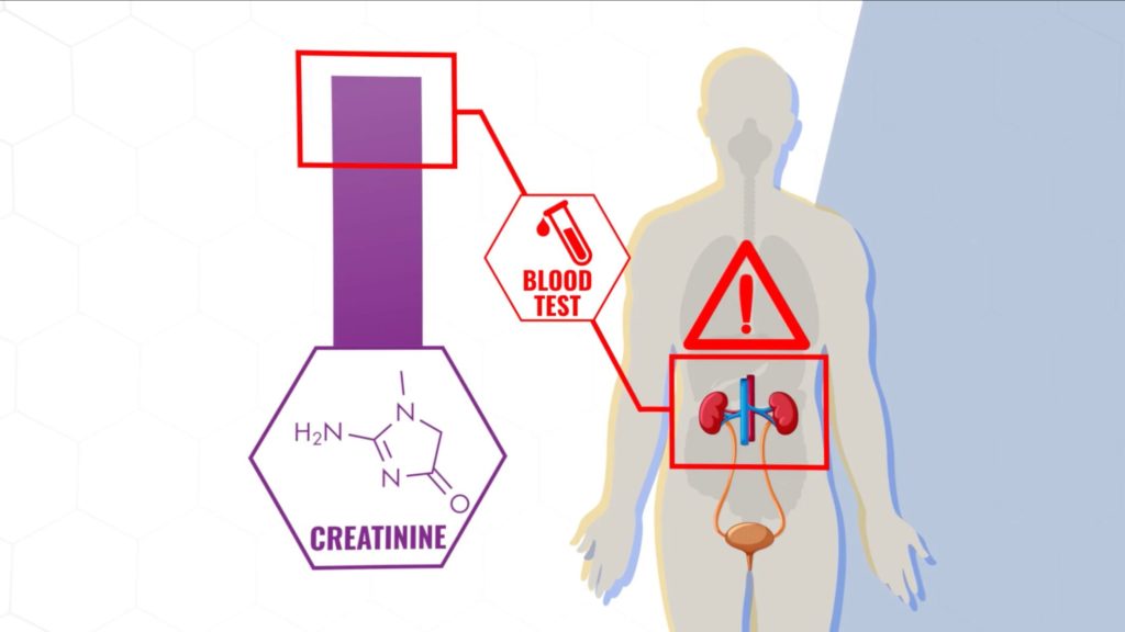 Creatine gets broken down into creatinine which can show up on blood tests creatine benefits