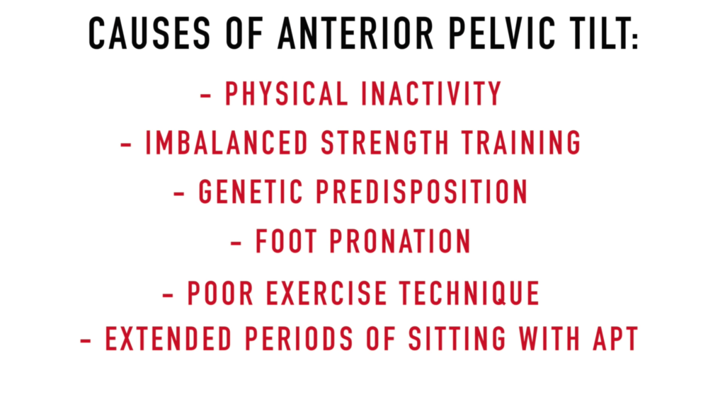 Causes of anterior pelvic tilt-min